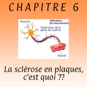 Lire la suite à propos de l’article Chapitre 6  – Qu’est ce que la sclérose en plaques, cette maladie auto-immune ? ?